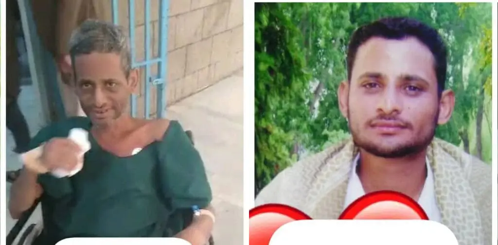 اليمن: وفاة أسير محرر أنهكه تعذيب ميليشيا الحوثي 2 photo 2025 02 19 09 17 52