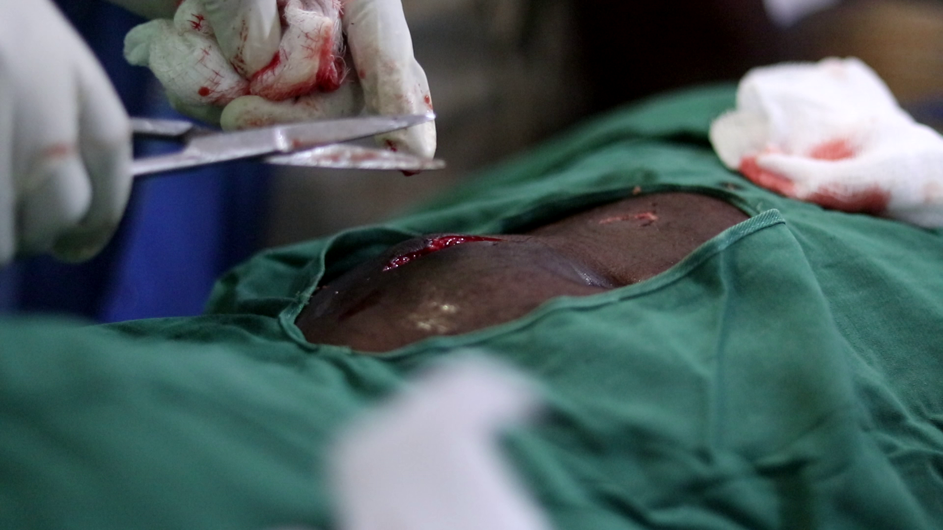 استشهاد 12 صوماليا أغلبهم أطفال ونساء في سلسلة غارات أمريكية جنوب الصومال 18 vlcsnap 2025 11 16 07h52m56s174