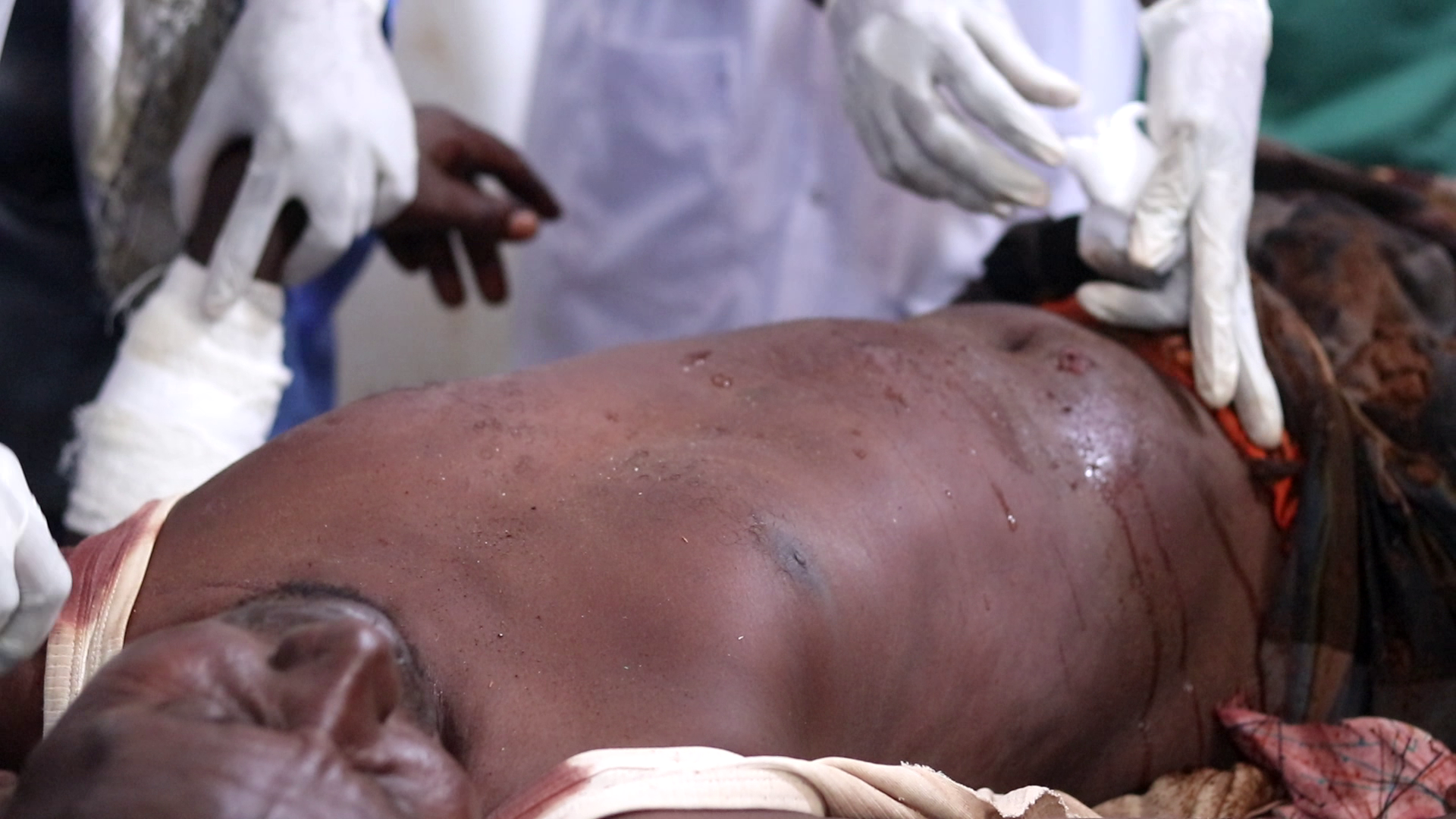 استشهاد 12 صوماليا أغلبهم أطفال ونساء في سلسلة غارات أمريكية جنوب الصومال 9 vlcsnap 2025 11 16 09h29m18s182