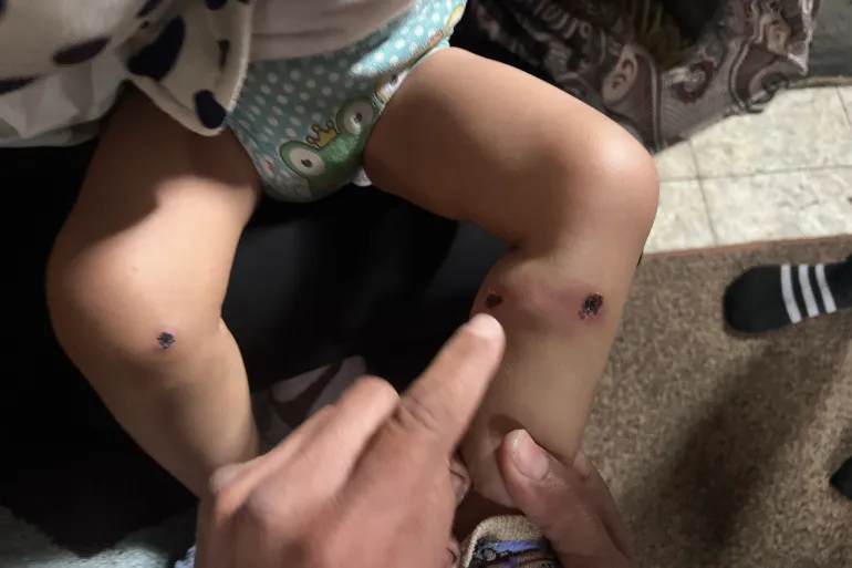 تعذيب الرضيع الفلسطيني جواد أبو نصار في قطاع غزة.