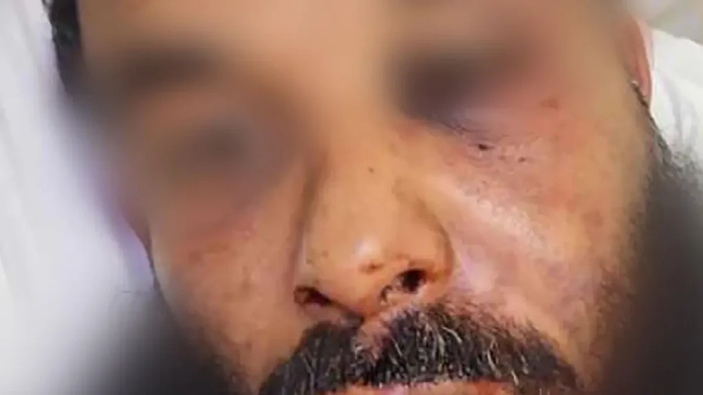 الإسلاموفوبيا في أستراليا.. هجوم على أب مسلم يكشف تصاعد الكراهية 2 الإسلاموفوبيا في أستراليا